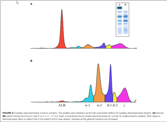 肝功能检查及病例分析